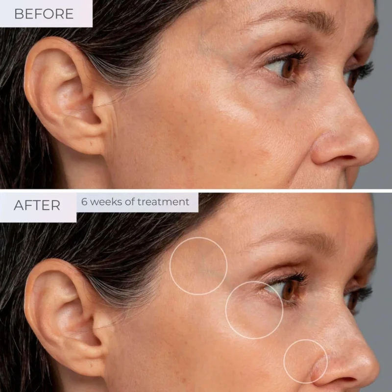 glow peptide before and after